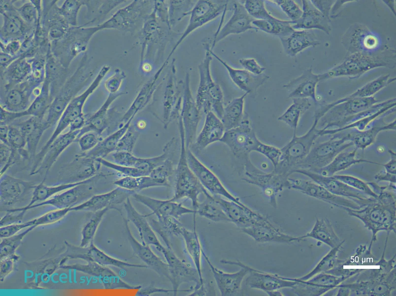 Human Dermal Papilla (Primary cell immortalization) Cell Complete Medium - 6