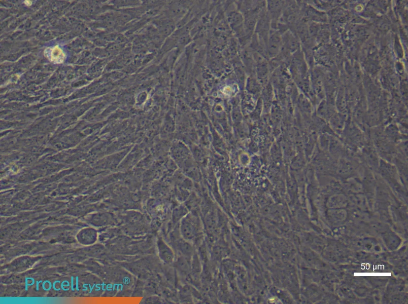 Human Mammary Cancer Fibroblast (Primary cell immortalization) Complete MediumHuman Mammary Cancer Fibroblast (Primary cell immortalization) Complete Medium - 4