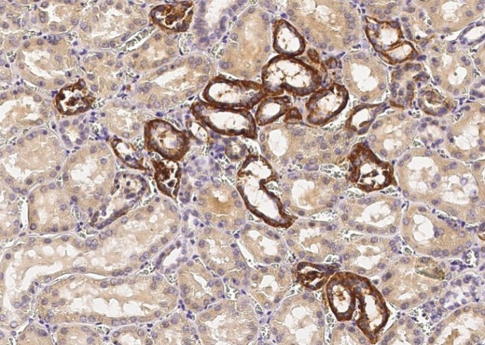 Recombinant VE-Cadherin/CD144 Monoclonal Antibody - small - 2