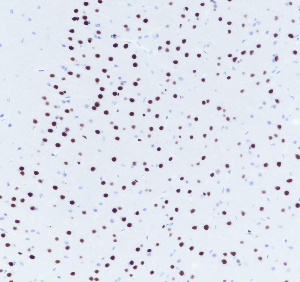 Recombinant SMARCC2/BAF170 Monoclonal Antibody - 3