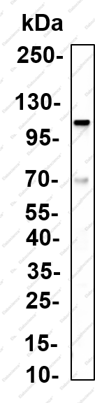 Recombinant PKD2 Monoclonal Antibody - 1