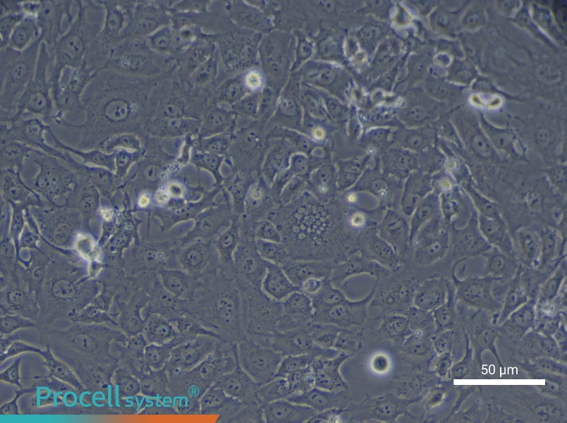Human Type II Alveolar Epithelial (Primary cell immortalization) Cell Complete Medium - 5