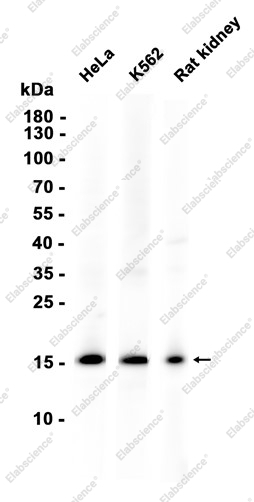 Recombinant RPS19 Monoclonal Antibody - 1