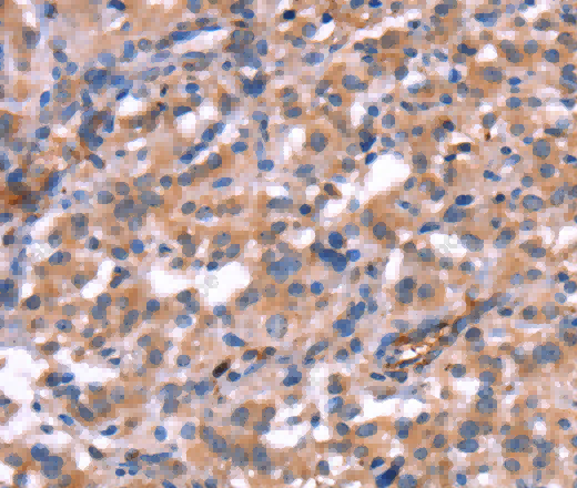 HMGCS1 Polyclonal Antibody - 3