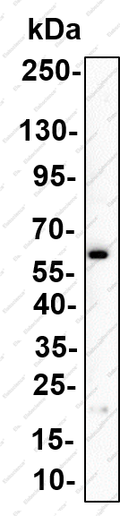 Recombinant SQSTM1/p62 (Phospho Ser349) Monoclonal Antibody - 1