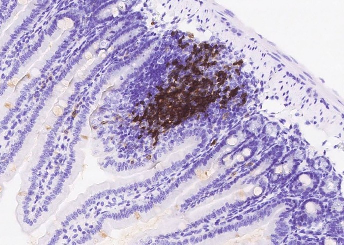 Recombinant CD79B/Ig-beta Monoclonal Antibody - small - 2