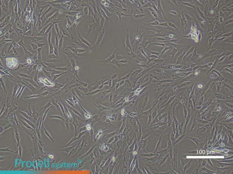 Rat Trabecular Meshwork Cell Complete Medium - 1