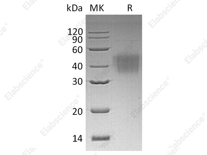 Recombinant Human CD16a/FCGR3A Protein (His Tag) - 1