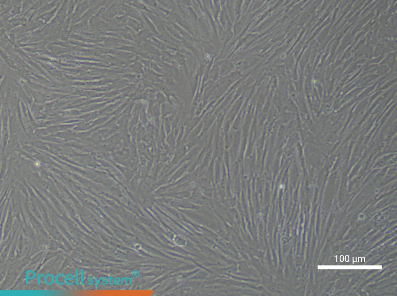Human Synovial Cell Complete Medium - 2