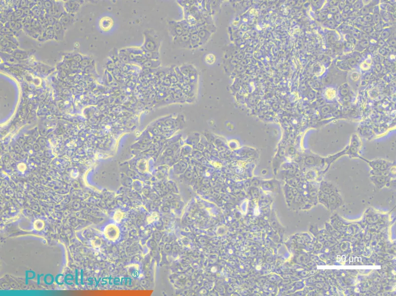 NCI-H1435NCI-H1435 - 3