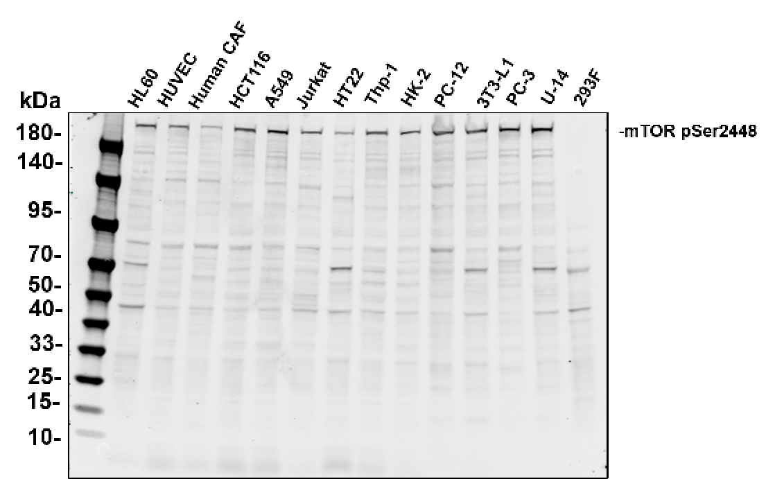 Recombinant Phospho-mTOR (Ser2448) Monoclonal Antibody - 1