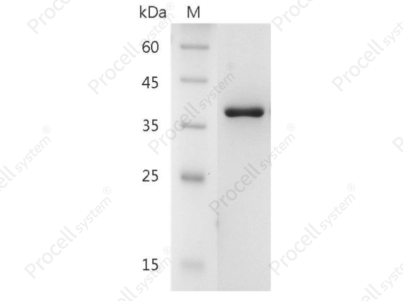 Galectin-8/LGALS8/PCTA-1/Po66-CBP, Human, Recombinant