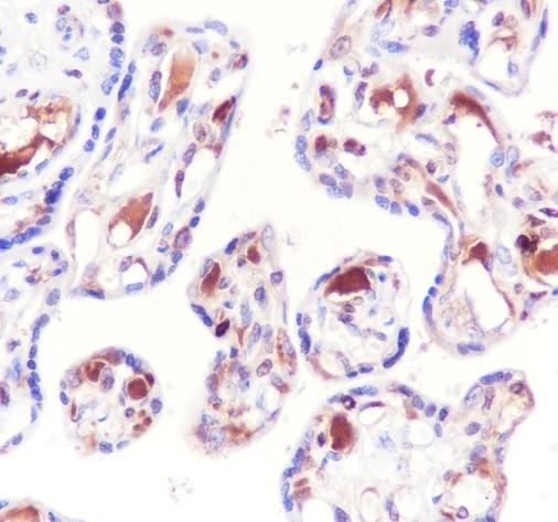 Recombinant AACT Monoclonal Antibody-searchlist-2