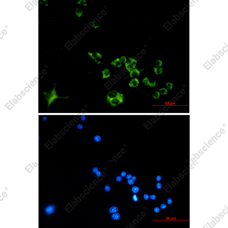 Recombinant Cathepsin B Monoclonal Antibody - 2