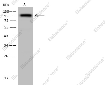 CD10 Monoclonal Antibody - 1