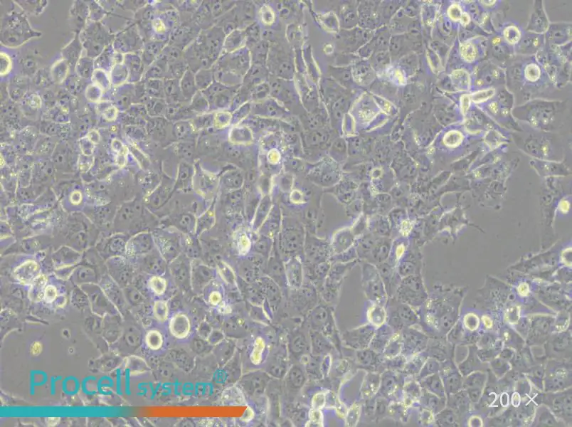 NCI-H1915 Cell Complete Medium - 4