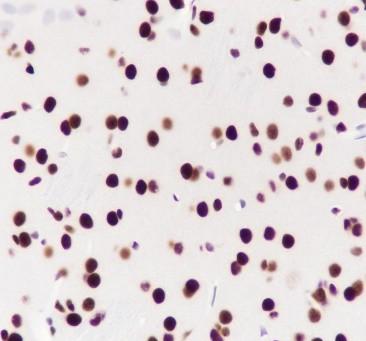 Recombinant ILF3 Monoclonal Antibody - small - 8