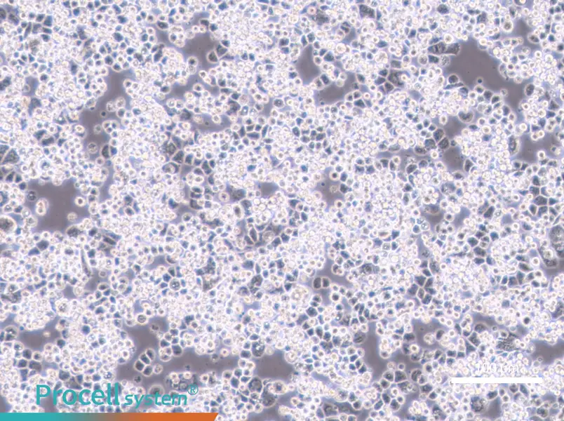 MDA-kb2 - 1