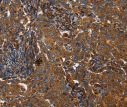 TPM2 Polyclonal Antibody - 2