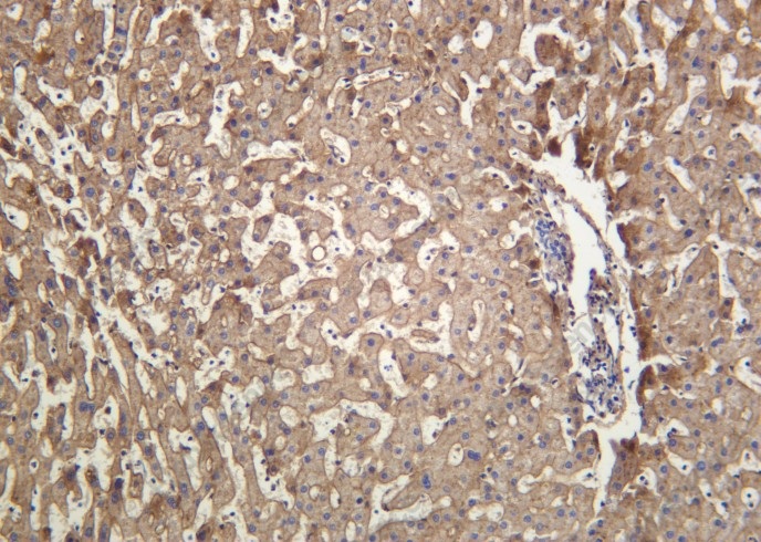 Recombinant ApoE Monoclonal Antibody - 2