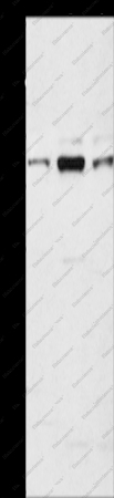 ARHGEF7 Polyclonal Antibody - 1