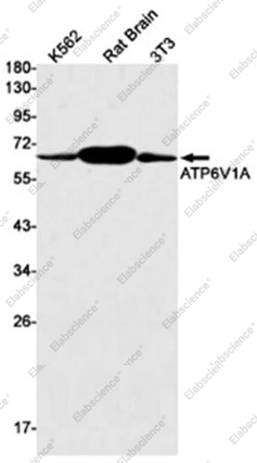 Recombinant ATP6V1A Monoclonal Antibody - 1