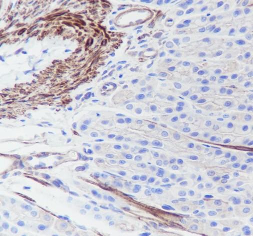 Recombinant Pan-Actin Monoclonal Antibody - small - 5