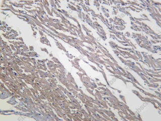 Recombinant NGF Monoclonal Antibody - 1