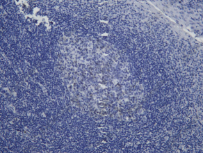 Recombinant WEE1 Monoclonal Antibody - 1