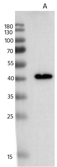 Adenosine Deaminase Monoclonal Antibody - small - 2