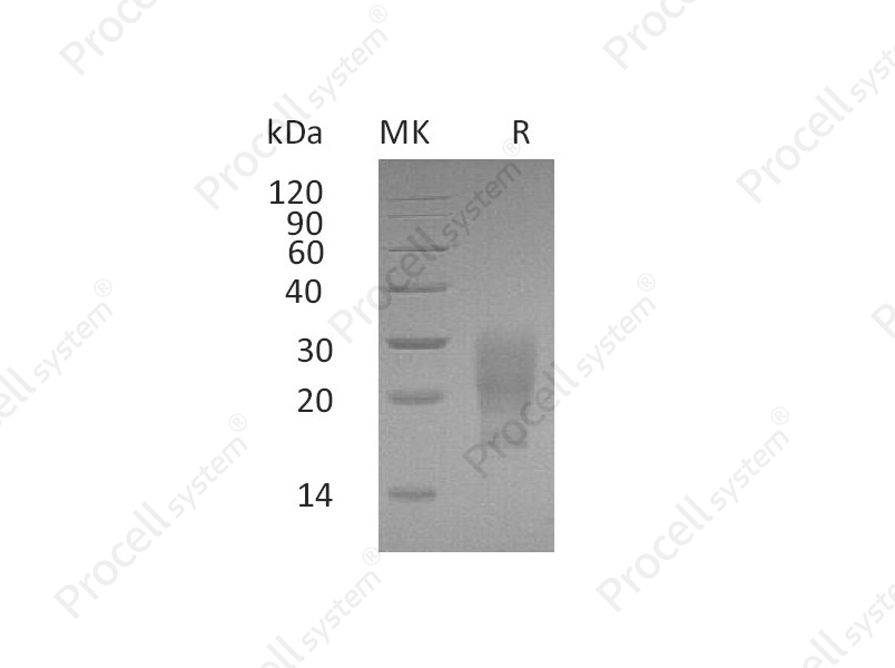 GM-CSF/CSF2 (C-6His, Cells), Human, Recombinant