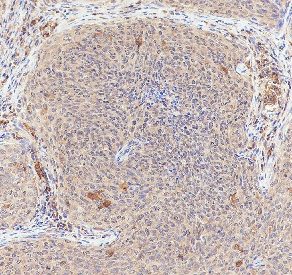 Recombinant EID1 Monoclonal Antibody - small - 4
