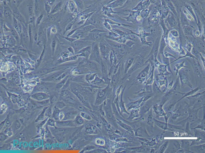 Mouse Follicular Theca cells - 5