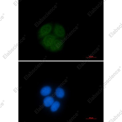 Recombinant UBE2C Monoclonal Antibody - 4