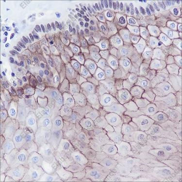 Recombinant TROP2 Monoclonal Antibody - 3