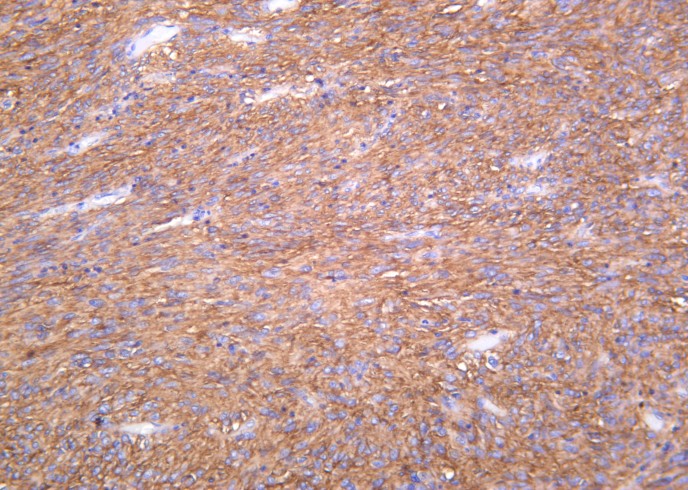 Recombinant TMEM16A Monoclonal Antibody-searchlist-1