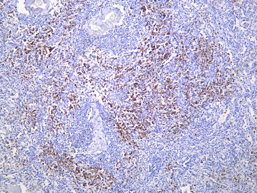 Recombinant CD15 Monoclonal Antibody - 1