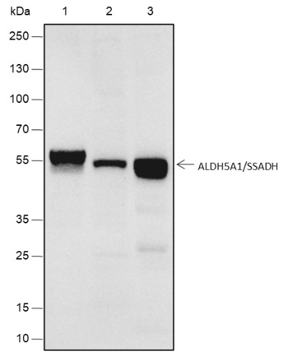Recombinant ALDH5A1/SSADH Monoclonal Antibody-searchlist-1