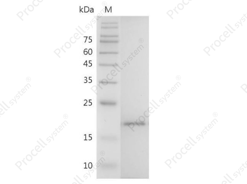 IL-38/IL1F10, Mouse, Recombinant
