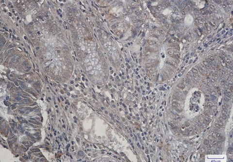 Recombinant P70 S6 Kinase beta Monoclonal Antibody - 4