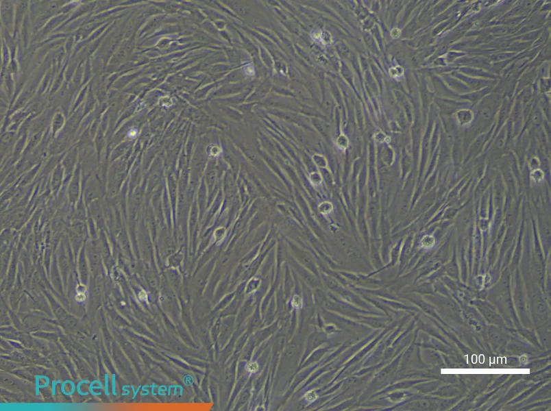 Human Gingival Fibroblast Complete Medium - 2