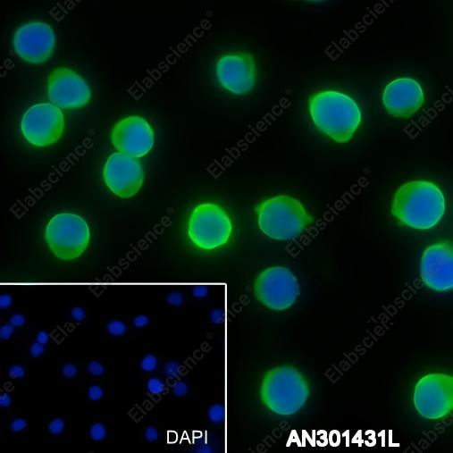 Recombinant ALDOA Monoclonal Antibody - 3