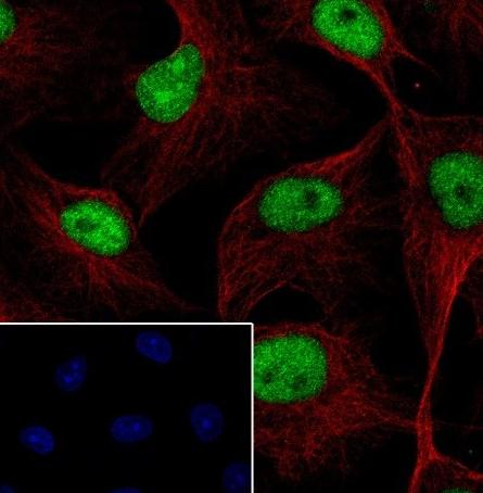 Recombinant MCM7 Monoclonal Antibody - small - 4