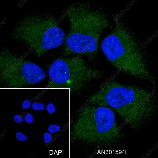 Recombinant MAGEA1 Monoclonal Antibody - 3
