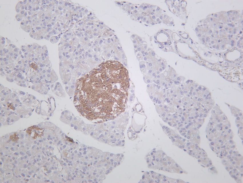 Recombinant DRP1 Monoclonal Antibody - small - 6