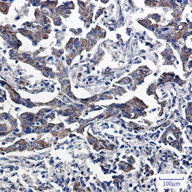 Recombinant Peroxiredoxin 5/PRDX5 Monoclonal Antibody - 3