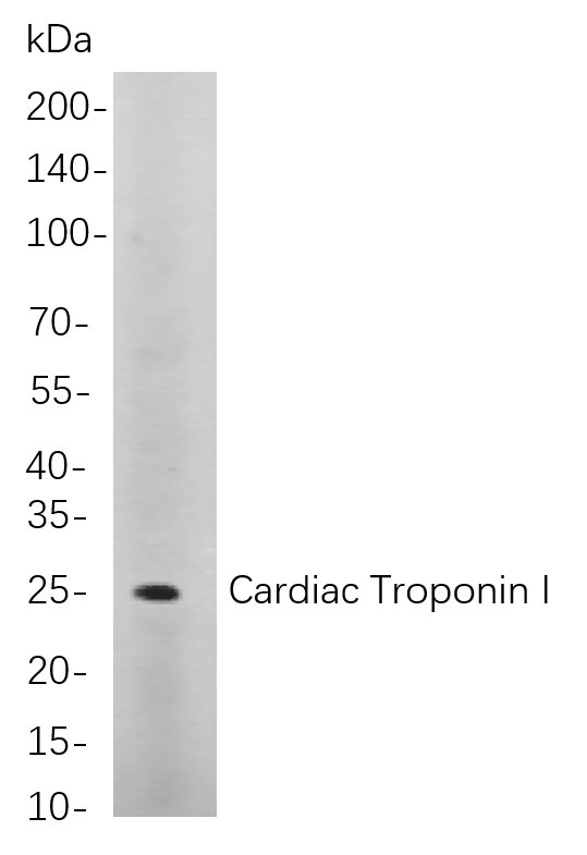 Recombinant Cardiac Troponin I Monoclonal Antibody-searchlist-1