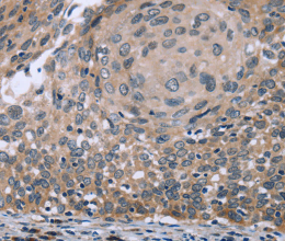 p53RFP Polyclonal Antibody - 3