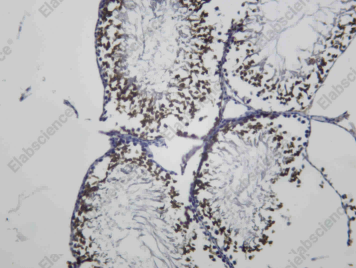 Recombinant KIF2C Monoclonal Antibody - 1