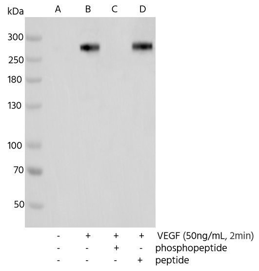 Recombinant Phospho-VEGF Receptor 2 (Tyr1175) Monoclonal Antibody - small - 3
